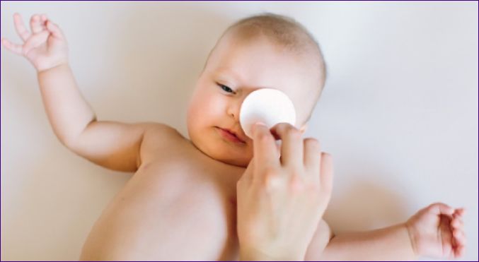 Elsősegélynyújtás, ha egy csecsemőnek könnyező szeme van