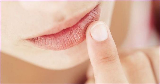 Kiszakadt ajkak: mit tegyünk otthon, ha az ajkak bőre nagyon kicserepesedett, 6 jogorvoslat áttekintése